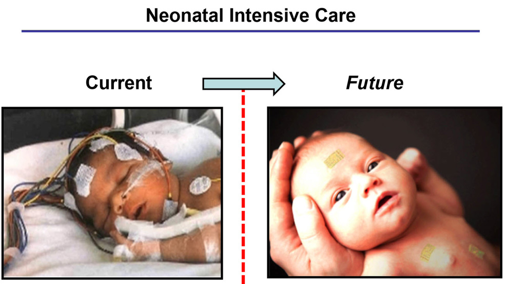Neonatal sensors