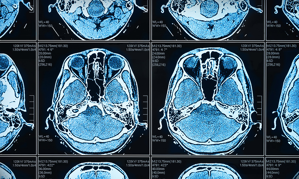 Brain scan shows biomedical optics at work