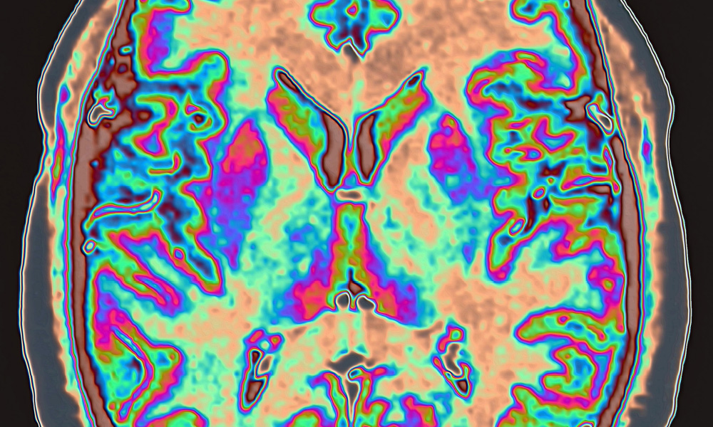 X-ray imaging for SPIE Medical Imaging