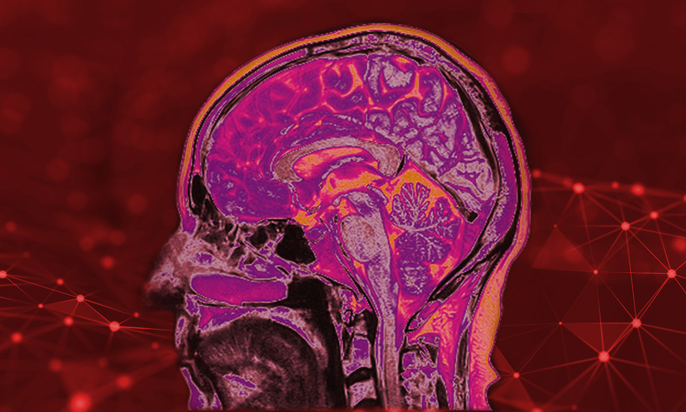 Brain scan shows how biomedical optics helps the medical community