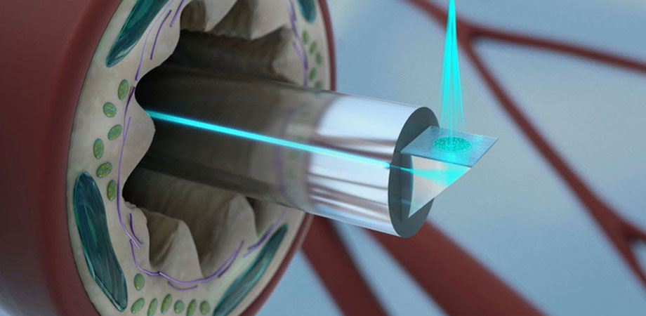 Nano-optic endoscope for high-resolution endoscopic OCT