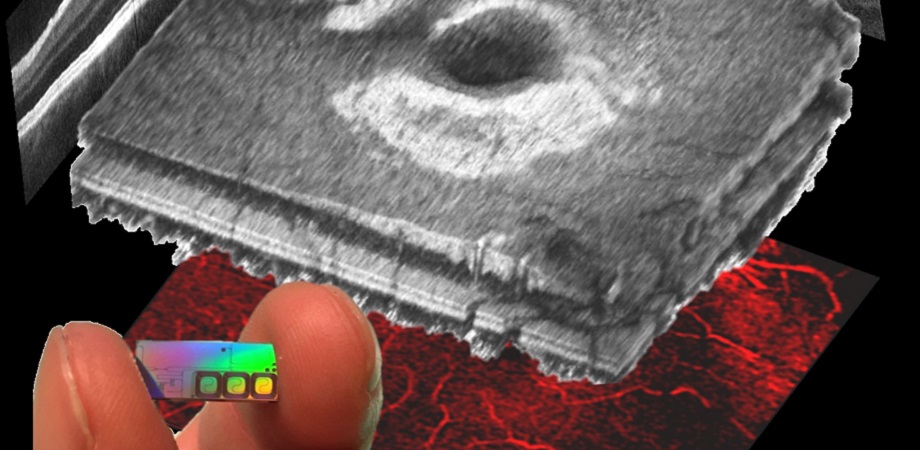 Ophthalmic OCT on a chip