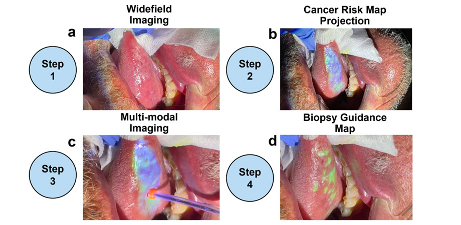 The active biopsy guidance system (ABGS) is a low-cost multi-imaging platform that helps clinicians identify suspicious looking lesions in the oral cavity in real time, facilitating the early detection of oral cancer